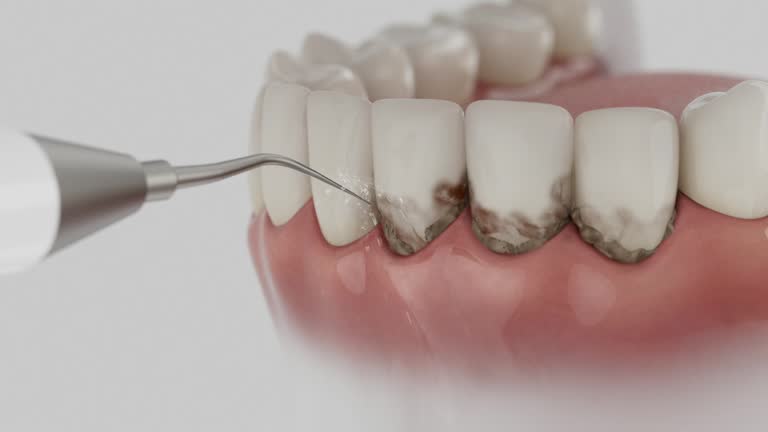 Reliable Wisdom Tooth Removal contractor in Fayette County County, TN by Dentist Open Now